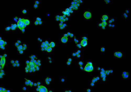Cellules de cancer colorectal après traitement par chimiothérapie FOLFORIXI pendant 34 semaines. Fibres cellulaires (en vert) et noyaux (en bleu). @UNIGE-Nowak-Sliwinka