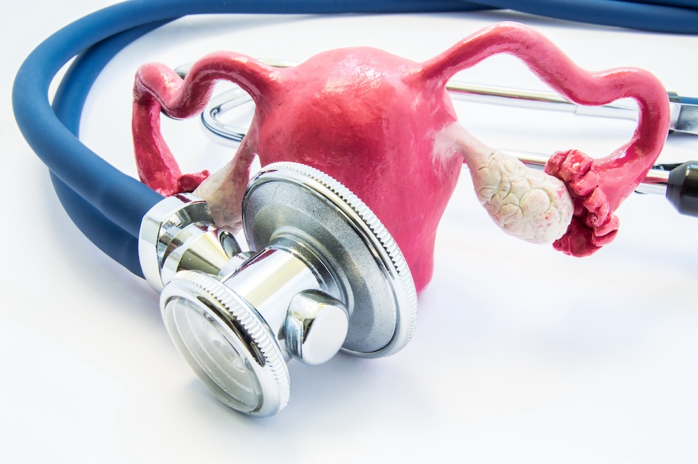 L’ablation des ovaires avant la ménopause augmente le risque de parkinsonisme MediQuality
