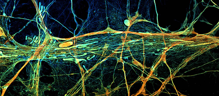 Mitochondries (structures tubulaires) au sein des filaments du cytosquelette de neurones observés en microscopie à fluorescence. © JMarine Laporte