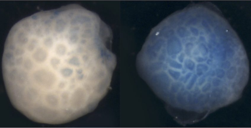 Organoïdes cérébraux humains en culture. L'organoïde de droite a été exposé à l'acide valproïque en culture, tandis que l'organoïde de gauche ne l'a pas été. La coloration pour le marqueur de sénescence (couleur bleue) montre que l'acide valproïque induit la sénescence cellulaire dans l'organoïde traité. © Muriel RHINN