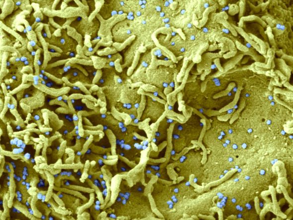 Microscopie électronique d'une cellule infectée par le SARS-CoV-2 © Philippe Roingeard, Anne Bull-Maurer, Sonia Georgeault, unité Inserm U1259 MAVIVH & Université de Tours, France.