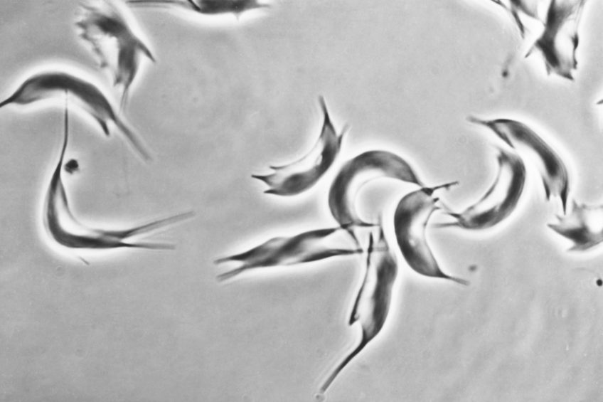 Globules rouges en forme de faucille (drépanocytose) ©Inserm/Chevance de Boisfleury, Anne-Marie